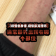 【疫情全身痒,疫情会发痒吗】