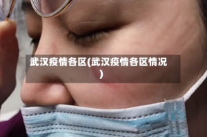 武汉疫情各区(武汉疫情各区情况)