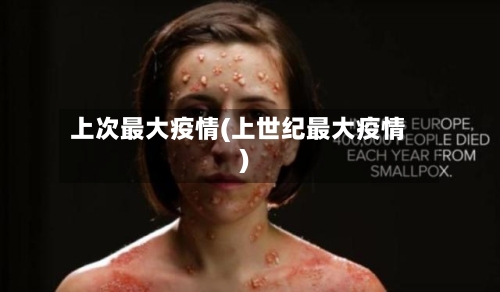 上次最大疫情(上世纪最大疫情)-第2张图片